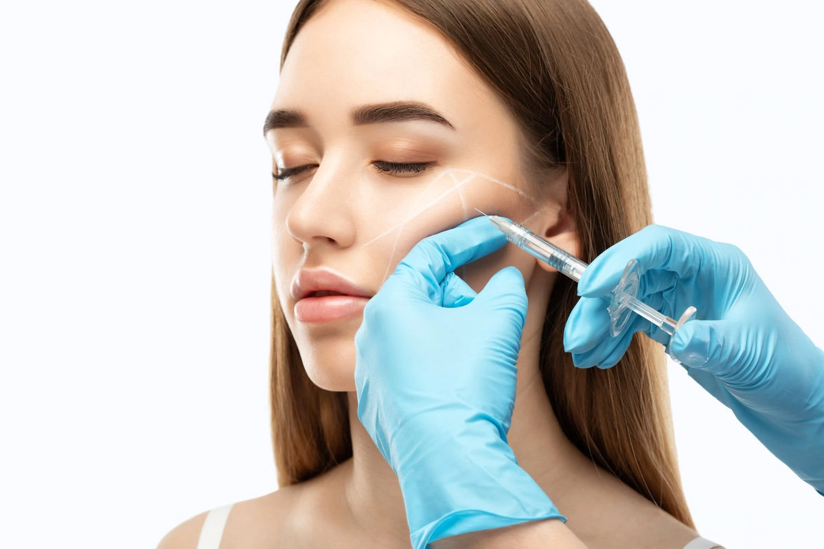 Dermal fillers by Micari Aesthetics and Wellness LLC in Bellmore, NY